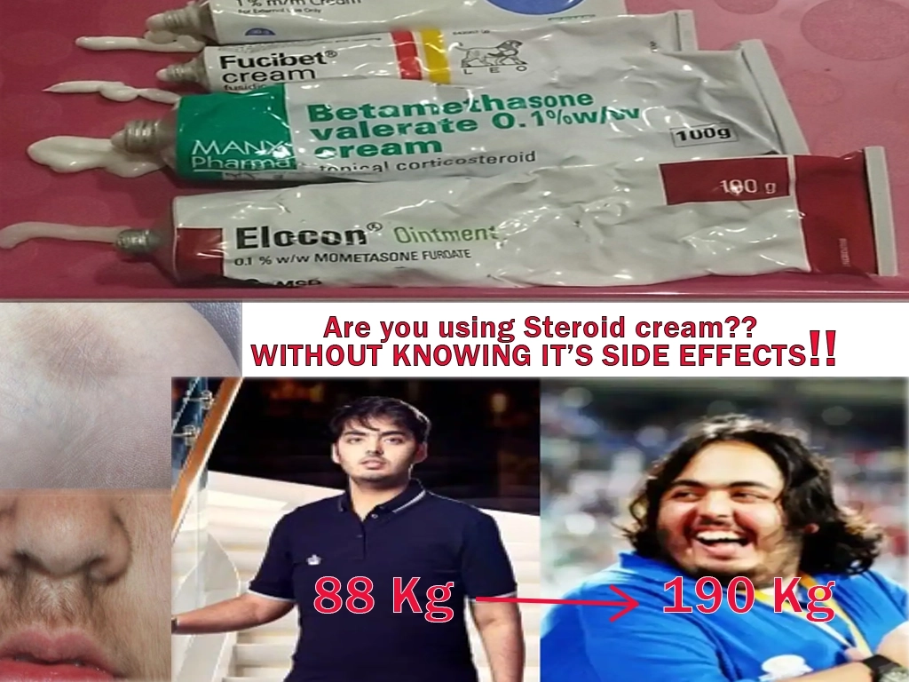 steroid cream, hair, weight gain